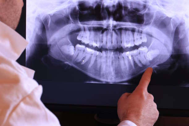 Best Knocked-Out Tooth (Avulsed Tooth) Treatment in Tolleson, AZ