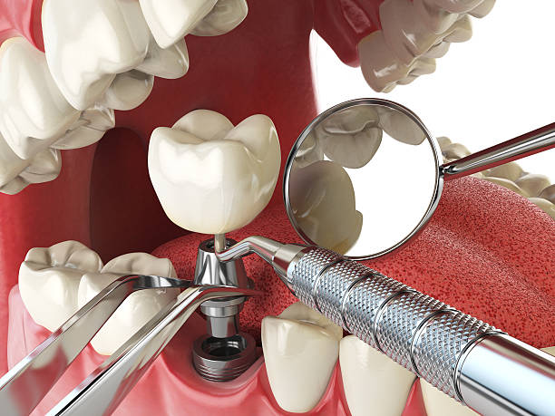 Best Broken or Chipped Tooth Repair in Tolleson, AZ